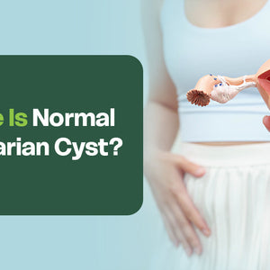  normal sized ovarian cyst