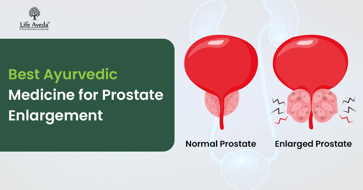 Ayurvedic Medicine for Prostate Enlargement