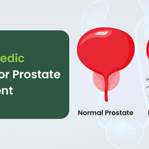 Ayurvedic Medicine for Prostate Enlargement