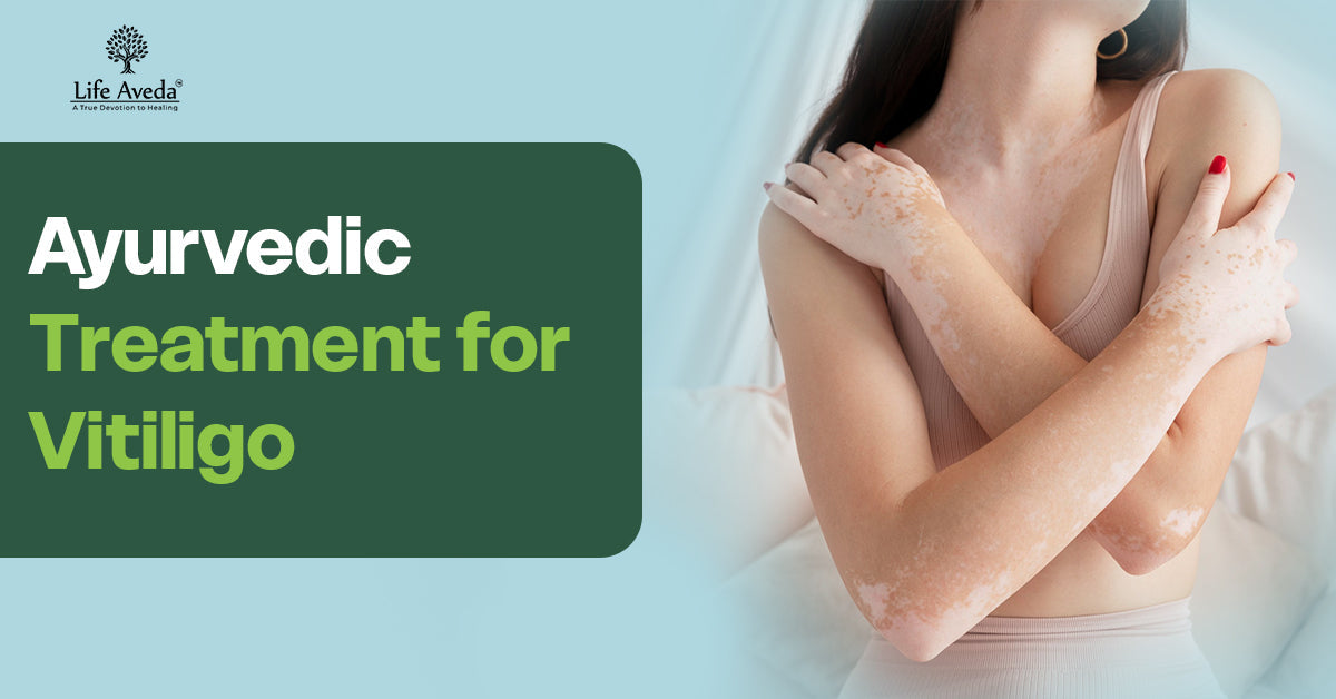  Ayurvedic treatment for vitiligo 