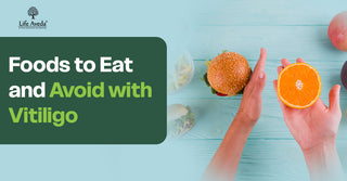  Ayurvedic treatment for vitiligo 