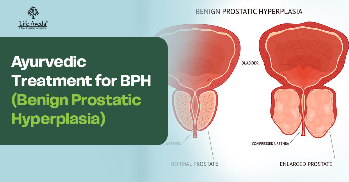 Ayurvedic Treatment for BPH