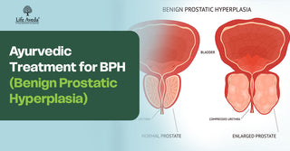 Ayurvedic Treatment for BPH
