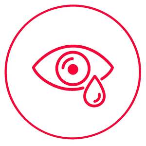Red & Watery Eyes