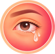 Watery eyes